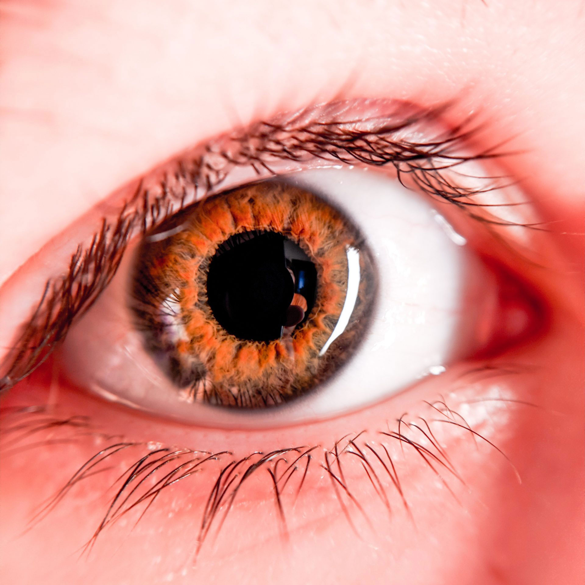 browneyecloseup CERA