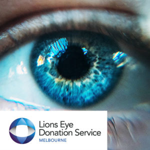 Photo of a blue eye and small logo of Lions Eye Donation Service
