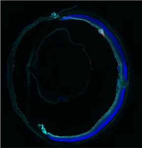 A cross section image of an eye