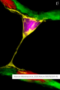 Scanning electron microscopy reconstruction of a single interpericyte tunneling nanotube connecting two distal vessels.