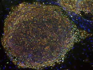 An image of stem cells, despiected as a circle of many tiny dots in multicolor.