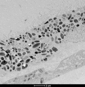 Black and white electron microscopy imaging of retinal pigment epithelium cells