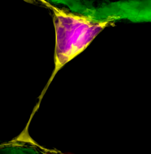 Image of ink and yellow nanotubes on a black background